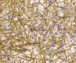 Organoid Sample A5 LAVENDEL